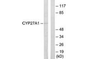 Western blot analysis of extracts from HeLa cells, using Cytochrome P450 27A1 Antibody. (CYP27A1 Antikörper  (AA 101-150))