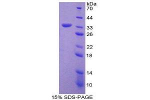 SDS-PAGE (SDS) image for Chemokine (C-C Motif) Ligand 7 (CCL7) (AA 24-99) protein (GST tag) (ABIN1980646) (CCL7 Protein (AA 24-99) (GST tag))