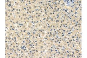ABIN7093263 and ABIN7097282 at 1/100 staining Rat ovarian tissue by IHC-P.
