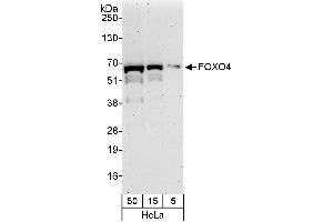 Western Blotting (WB) image for anti-Forkhead Box O4 (FOXO4) (AA 455-505) antibody (ABIN7453088)