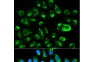 Immunofluorescence analysis of HeLa cells using GAS2 Polyclonal Antibody (GAS2 Antikörper)