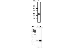 The cell lysates (40ug) were resolved by SDS-PAGE, transferred to PVDF membrane and probed with anti-human FKBP14 antibody (1:1000). (FKBP14 Antikörper)