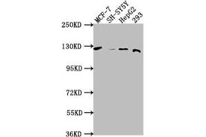 Western Blot Positive WB detected in: MCF-7 whole cell lysate, SH-SY5Y whole cell lysate, HepG2 whole cell lysate, 293 whole cell lysate All lanes: WWC3 antibody at 1:1000 Secondary Goat polyclonal to rabbit IgG at 1/50000 dilution Predicted band size: 123, 66 kDa Observed band size: 123 kDa (WWC3 Antikörper  (AA 65-85))