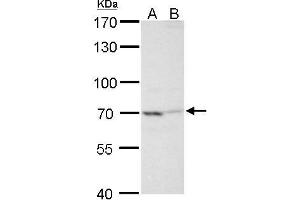 WB Image TNF alpha IP2 antibody detects TNF alpha IP2 protein by Western blot analysis. (TNIP2 Antikörper  (Center))