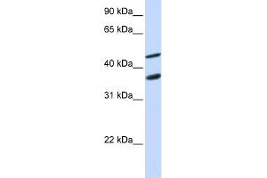WB Suggested Anti-GAS7 Antibody Titration:  0.