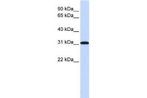 WB Suggested Anti-RPA4 Antibody Titration: 0.