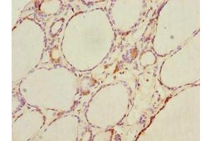 Immunohistochemistry of paraffin-embedded human thyroid tissue using ABIN7164417 at dilution of 1:100 (DTX2 Antikörper  (AA 1-280))