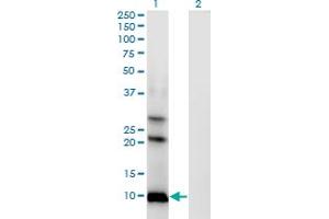 Western Blot analysis of AKR1CL1 expression in transfected 293T cell line by AKR1CL1 monoclonal antibody (M04), clone 4G8. (AKR1CL1 Antikörper  (AA 1-129))