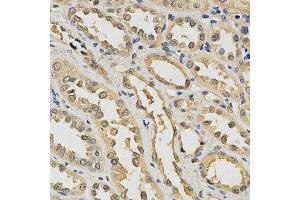 Immunohistochemistry of paraffin-embedded human kidney using PDGFRB antibody at dilution of 1:200 (x400 lens) (PDGFRB Antikörper)