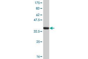 Western Blot detection against Immunogen (37. (FEN1 Antikörper  (AA 1-110))