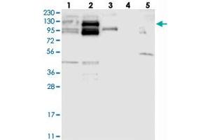 Western blot analysis of Lane 1: RT-4, Lane 2: U-251 MG, Lane 3: Human Plasma, Lane 4: Liver, Lane 5: Tonsil with CYTSB polyclonal antibody .
