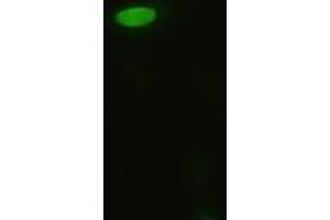 Anti-MAPK8 mouse monoclonal antibody (ABIN2452351) immunofluorescent staining of HeLa cells transiently transfected by pCMV6-ENTRY MAPK8 (RC218407) (JNK Antikörper  (AA 1-384))