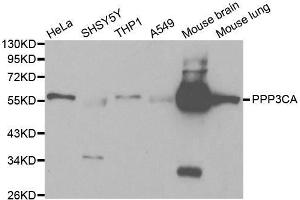 Western blot analysis of extracts of various cell lines, using PPP3CA antibody. (PPP3CA Antikörper  (AA 1-511))