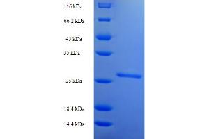 SDS-PAGE (SDS) image for Thyroid Stimulating Hormone, beta (TSHB) (AA 21-132) protein (His-SUMO Tag) (ABIN5710554) (TSHB Protein (AA 21-132) (His-SUMO Tag))