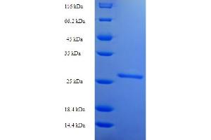SDS-PAGE (SDS) image for Thyroid Stimulating Hormone, beta (TSHB) (AA 21-132) protein (His-SUMO Tag) (ABIN5710554)