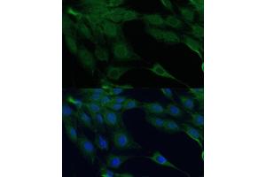 Immunofluorescence (IF) image for anti-Death-Associated Protein Kinase 3 (DAPK3) (AA 1-100) antibody (ABIN7266712)
