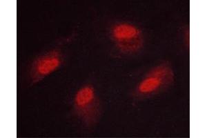 ABIN6267669 staining HeLa cells by ICC/IF. (CAMK4 Antikörper  (pThr200))