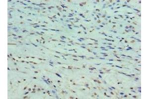 Immunohistochemistry (IHC) image for anti-Protein Phosphatase 1, Regulatory (Inhibitor) Subunit 1B (PPP1R1B) (AA 1-168), (Regulatory Subunit 1B) antibody (ABIN7165931)