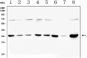 Western blot analysis of PITX2 using anti-PITX2 antibody (ABIN7603131).