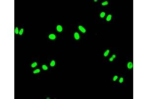 Immunofluorescence staining of Hela Cells with ABIN7127503 at 1:50, counter-stained with DAPI. (Rekombinanter FUBP1 Antikörper)