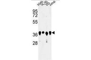 Western blot analysis of ARGLU1 Antibody (N-term) in A549, HL-60, 293, Jurkat cell line lysates (35µg/lane).