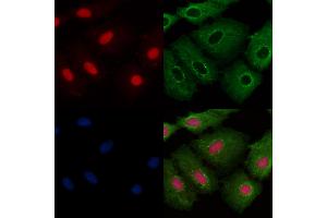 ABIN6256824 and ABIN6273425 staining  cells by IF/ICC. (ATRAID Antikörper  (Internal Region))