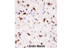Immunohistochemistry (IHC) image for anti-Homeobox A7 (HOXA7) antibody (ABIN2998012) (HOXA7 Antikörper)
