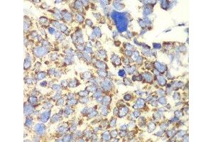 Immunohistochemistry (Paraffin-embedded Sections) (IHC (p)) image for anti-Glutamate Dehydrogenase 2 (GLUD2) antibody (ABIN7011241)