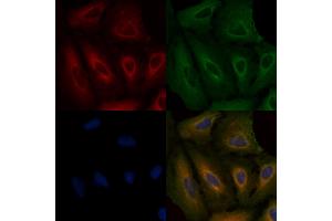 ABIN6264219 and ABIN6279663 staining  cells by IF/ICC. (PIK3R6 Antikörper  (C-Term))
