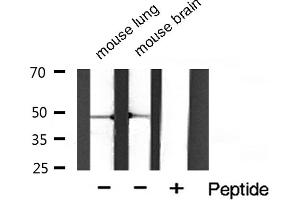 Western blot analysis of Phospho-HDAC3 (Ser424) Antibody expression in mouse lung and mouse brain tissues lysates. (HDAC3 Antikörper  (pSer424))