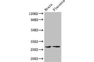 Western Blot Positive WB detected in: Mouse brain tissue, Human placenta tissue All lanes: FBXL22 antibody at 3 μg/mL Secondary Goat polyclonal to rabbit IgG at 1/50000 dilution Predicted band size: 28 kDa Observed band size: 28 kDa (FBXL22 Antikörper  (AA 123-229))