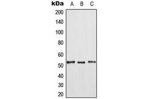 Western blot analysis of TPL2 (pT290) expression in HepG2 (A), mouse liver (B), rat liver (C) whole cell lysates. (MAP3K8 Antikörper  (pSer290))