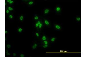 Image no. 3 for anti-TATA Box Binding Protein Associated Factor 11 (TAF11) (AA 158-211) antibody (ABIN598958) (TAF11 Antikörper  (AA 158-211))