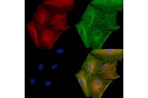 ABIN6261126 and ABIN6277912 staining  cells by IF/ICC. (CXCR1 Antikörper  (N-Term))