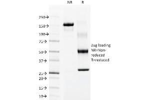 SDS-PAGE Analysis Purified Cytokeratin 15 Mouse Monoclonal Antibody (LHK15). (KRT15 Antikörper  (C-Term))