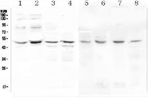 Western blot analysis of KCNN4 using anti-KCNN4 antibody (ABIN6719494).