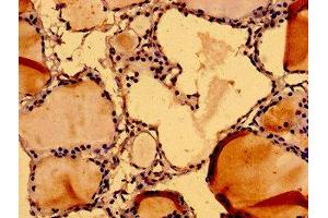 Immunohistochemistry of paraffin-embedded human thyroid tissue using ABIN7161807 at dilution of 1:100