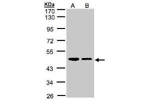WB Image Sample(30 ug whole cell lysate) A:A431, B:H1299 10% SDS PAGE antibody diluted at 1:1000 (ERP44 Antikörper)