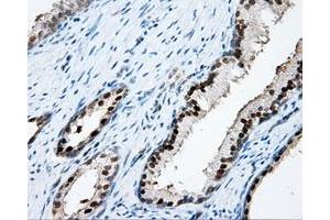 Immunohistochemical staining of paraffin-embedded Kidney tissue using anti-APP mouse monoclonal antibody. (APP Antikörper)