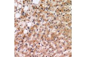 Immunohistochemical analysis of IL-19 staining in human liver formalin fixed paraffin embedded tissue section. (IL-19 Antikörper)
