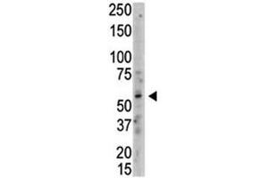 Western Blotting (WB) image for anti-Protein Arginine Methyltransferase 3 (PRMT3) (AA 460-491) antibody (ABIN3032359)