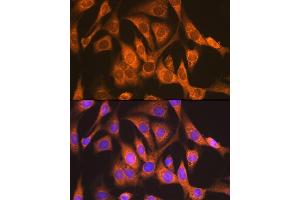 Immunofluorescence analysis of NIH-3T3 cells using NDUFS4 Rabbit mAb (ABIN7268821) at dilution of 1:100 (40x lens).