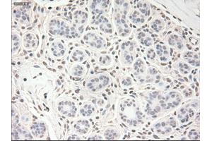 Immunohistochemical staining of paraffin-embedded breast tissue using anti-VEGF mouse monoclonal antibody. (VEGF Antikörper  (AA 27-233))