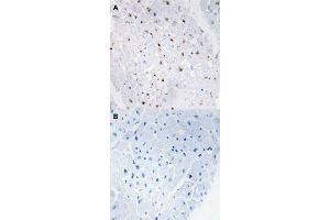 Immunohistochemical staining (Formalin-fixed paraffin-embedded sections) of human heart tissue with BLM (phospho T99) polyclonal antibody  without blocking peptide (A) or preincubated with blocking peptide (B) under 1:50-1:100 dilution. (BLM Antikörper  (pThr99))