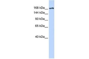WB Suggested Anti-KDR Antibody Titration:  0. (VEGFR2/CD309 Antikörper  (N-Term))