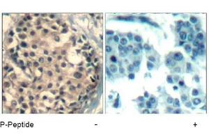 Image no. 2 for anti-HDAC4,HDAC5,HDAC9 (pSer220), (pSer246), (pSer259) antibody (ABIN319280) (HDAC4/HDAC5/HDAC9 Antikörper  (pSer220, pSer246, pSer259))