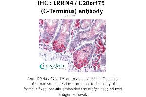 Image no. 1 for anti-Leucine Rich Repeat Neuronal 4 (LRRN4) (C-Term) antibody (ABIN1736586) (LRRN4 Antikörper  (C-Term))
