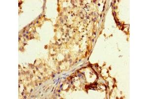 Immunohistochemistry of paraffin-embedded human testis tissue using ABIN7152285 at dilution of 1:100 (EXOSC3 Antikörper  (AA 2-275))
