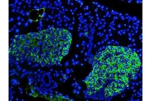 IF analysis of SYP using anti-SYP antibody (ABIN3042768). (Synaptophysin Antikörper  (N-Term))
