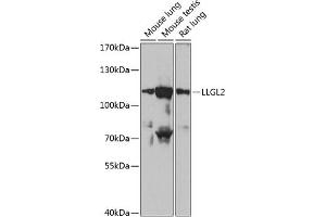 Western blot analysis of extracts of various cell lines, using LLGL2 antibody (ABIN6134714, ABIN6143260, ABIN6143263 and ABIN6217274) at 1:1000 dilution. (LLGL2 Antikörper  (AA 900-1000))